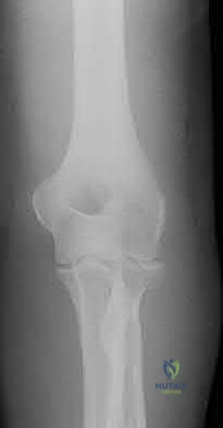 Illustration 168 for OrthoCash: Trauma MCQs & Cases for a yearold woman