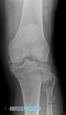 Illustration 183 for OrthoCash: Trauma MCQs & Cases for a yearold woman