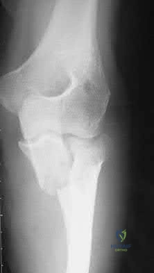 Illustration 31 for OrthoCash: Trauma MCQs & Cases for a yearold woman