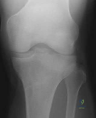 Illustration 38 for OrthoCash: Trauma MCQs & Cases for a yearold woman