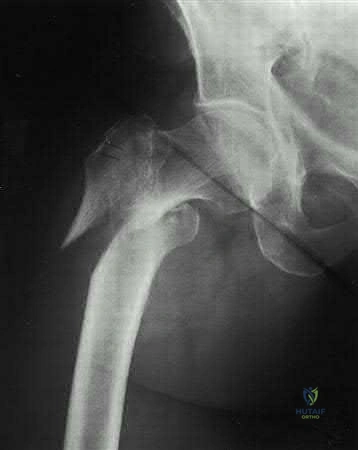 Illustration 7 for OrthoCash: Trauma MCQs & Cases for a yearold woman
