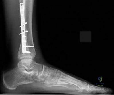Illustration 63 for OrthoCash: Trauma MCQs & Cases for a yearold woman