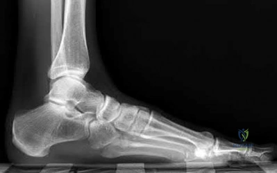 Illustration 103 for OrthoCash: Trauma MCQs & Cases for a yearold woman