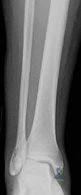 Illustration 142 for OrthoCash: Trauma MCQs & Cases for a yearold woman