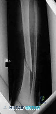 Illustration 146 for OrthoCash: Trauma MCQs & Cases for a yearold woman