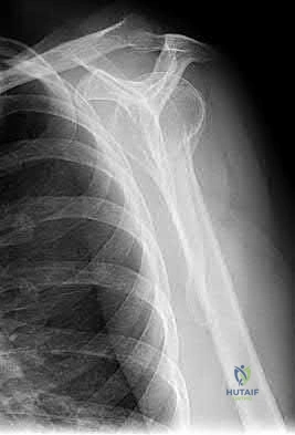 Illustration 150 for OrthoCash: Trauma MCQs & Cases for a yearold woman