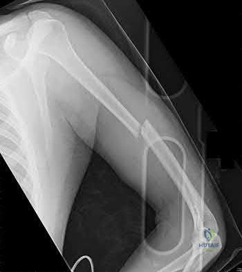 Illustration 131 for OrthoCash: Trauma MCQs & Cases for a yearold woman