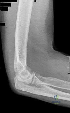 Illustration 76 for OrthoCash: Trauma MCQs & Cases for a yearold woman