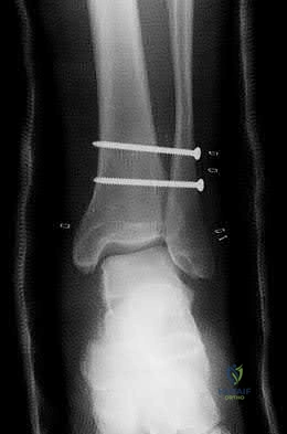Illustration 52 for OrthoCash: Trauma MCQs & Cases for a yearold woman