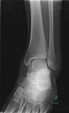 Illustration 118 for OrthoCash: Trauma MCQs & Cases for a yearold woman