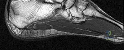 Illustration 105 for OrthoCash: Trauma MCQs & Cases for a yearold woman