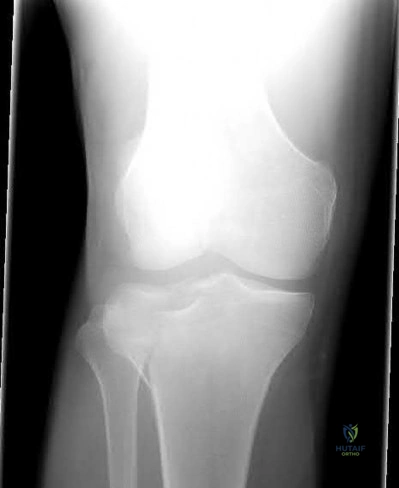 Illustration 115 for OrthoCash: Trauma MCQs & Cases for a yearold woman