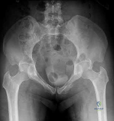 Illustration 192 for OrthoCash: Trauma MCQs & Cases for a yearold woman