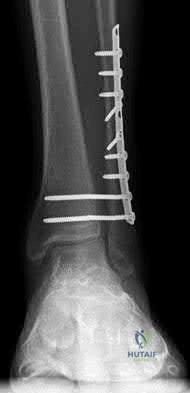 Illustration 62 for OrthoCash: Trauma MCQs & Cases for a yearold woman