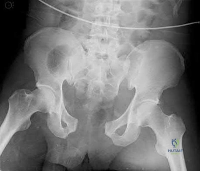 Illustration 182 for OrthoCash: Trauma MCQs & Cases for a yearold woman