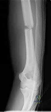 Illustration 174 for OrthoCash: Trauma MCQs & Cases for a yearold woman