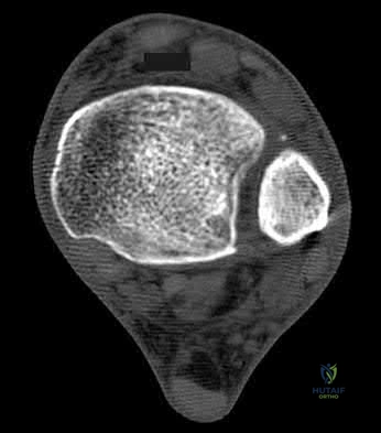 Illustration 64 for OrthoCash: Trauma MCQs & Cases for a yearold woman