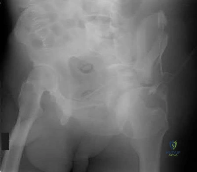 Illustration 23 for OrthoCash: Trauma MCQs & Cases for a yearold woman