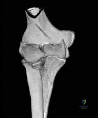 Illustration 33 for OrthoCash: Trauma MCQs & Cases for a yearold woman