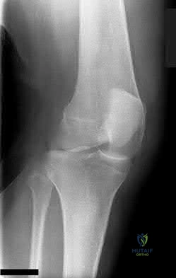 Illustration 67 for OrthoCash: Trauma MCQs & Cases for a yearold woman