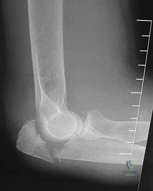 Illustration 172 for OrthoCash: Trauma MCQs & Cases for a yearold woman