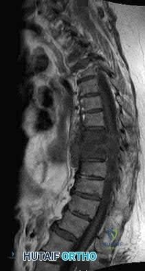 Illustration 10 for OrthoCash: Trauma MCQs & Cases for a yearold woman