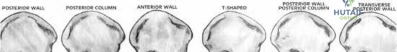 Illustration 12 for OrthoCash: Trauma MCQs & Cases for a yearold woman
