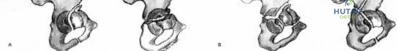 Illustration 15 for OrthoCash: Trauma MCQs & Cases for a yearold woman