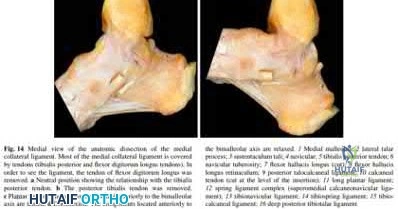 Illustration 102 for OrthoCash: Trauma MCQs & Cases for a yearold woman