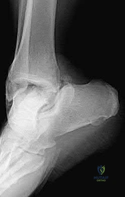 Illustration 6 for OrthoCash: Trauma MCQs & Cases for a yearold woman