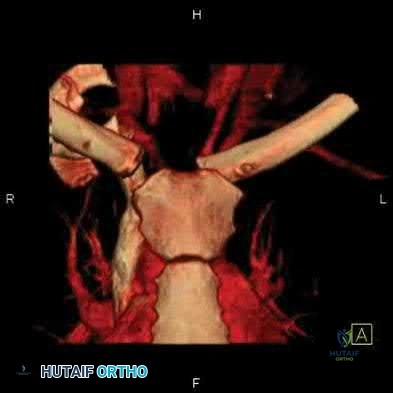 Illustration 46 for OrthoCash: Trauma MCQs & Cases for a yearold woman