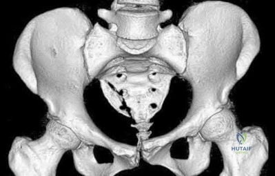 Illustration 127 for OrthoCash: Trauma MCQs & Cases for a yearold woman