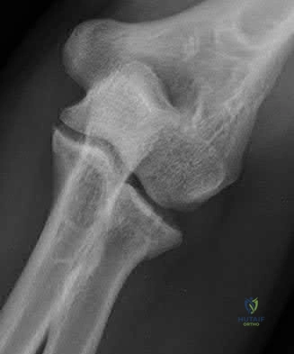 Illustration 35 for OrthoCash: Trauma MCQs & Cases for a yearold woman