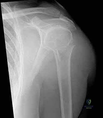 Illustration 180 for OrthoCash: Trauma MCQs & Cases for a yearold woman
