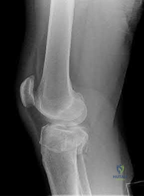 Illustration 184 for OrthoCash: Trauma MCQs & Cases for a yearold woman