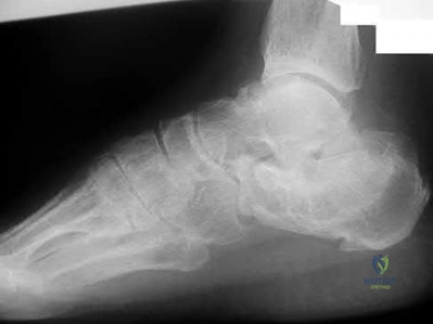 Illustration 99 for OrthoCash: Trauma MCQs & Cases for a yearold woman