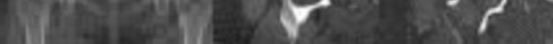 Orthopedic MCQs: Can You Master the Branch of the Radial?