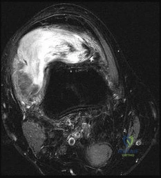 Orthopedic Pathology MCQs: Master PubMed Question of Figures