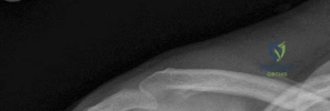 Orthopedic MCQs: Sharpen Your Diagnostic Eye per Highpowered Field