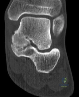 Orthopedic MCQs: Tackle All Scenario L H Questions & Ace Your Exam.
