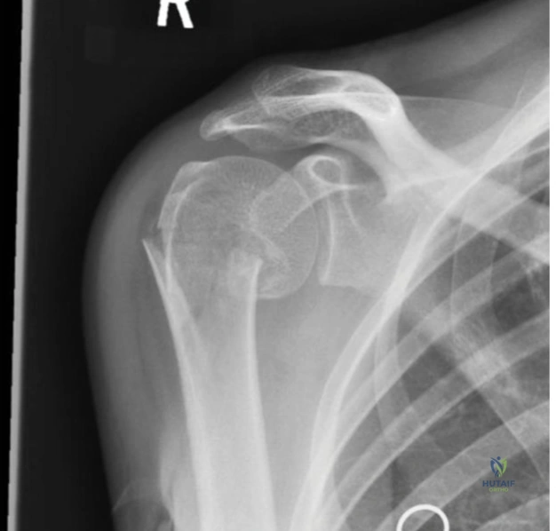 Clinical Image
