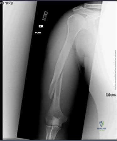 Orthopedic Surgery Mock Exam - Set 6691DD