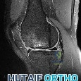 Orthopedic Surgery Mock Exam - Set 674211
