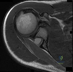 Illustration of pediatric orthopaedic scored - Dr. Mohammed Hutaif