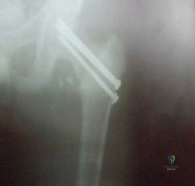 Orthopedic Surgery Mock Exam - Set EFEE5E