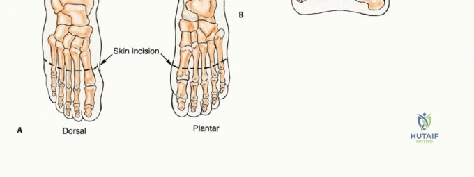 Orthopedic Prometric MCQs - Chapter 4 Part 6