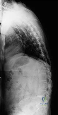 Orthopedic MCqs
