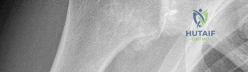 Illustration of scenario l l - Dr. Mohammed Hutaif