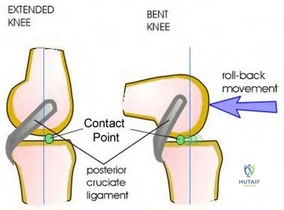 Patient Evaluation and Surgical Management of the Spastic Upper Extremity
