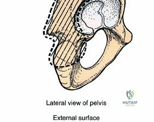 Illustration of acetabulum posterior approach - Dr. Mohammed Hutaif